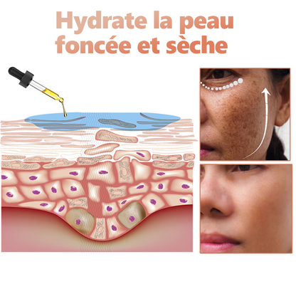 🔥VENTE DU DERNIER JOUR - 80 % DE RÉDUCTION) 🔥Lenaro™  Sérum visage correcteur de mélanine