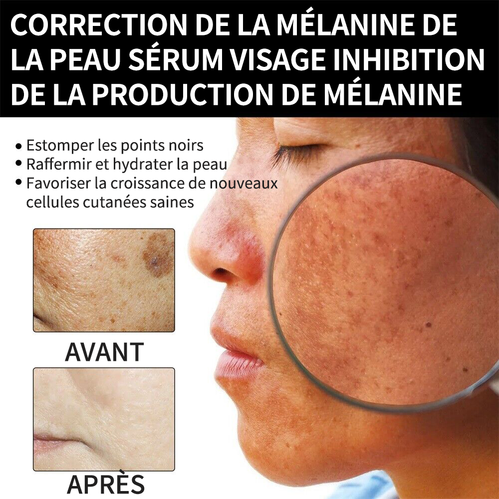 🔥(Vente du dernier jour - 80% de réduction) - LEFUN® Crème Correctrice à la Mélanine