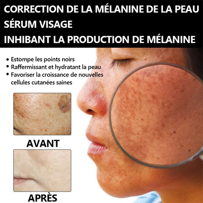 🔥VENTE DU DERNIER JOUR - 80 % DE RÉDUCTION) 🔥Lenaro™  Sérum visage correcteur de mélanine