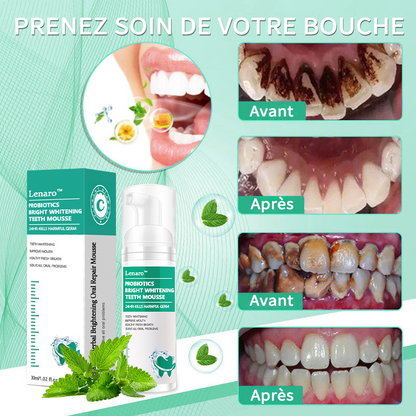 ✨(Vente du dernier jour - 50% de réduction)✨Lenaro™ Mousse réparatrice orale éclaircissante à base de plantes💛