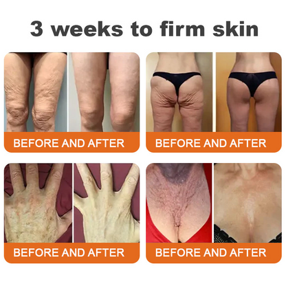 Made and Shipped from USA✅𝑻𝑳𝑶𝑷𝑨® Botox Bee Venom Firming Serum Stick(🔥LAST DAY 70% OFF) ❤️