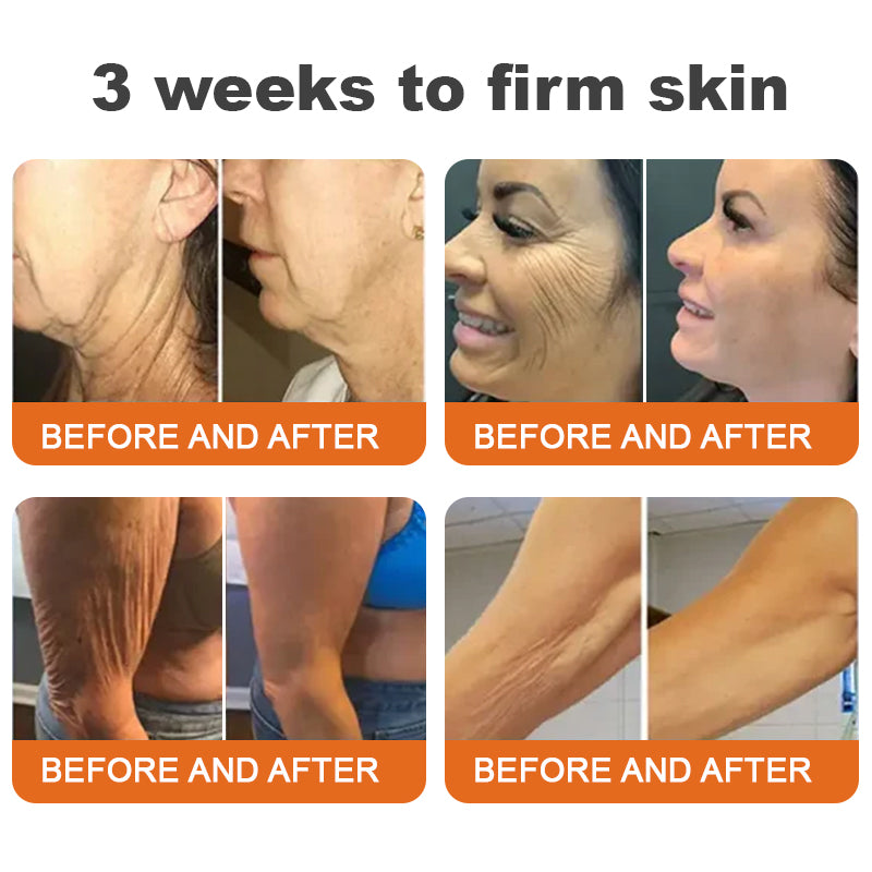 Made and Shipped from USA✅𝑻𝑳𝑶𝑷𝑨® Botox Bee Venom Firming Serum Stick(🔥LAST DAY 70% OFF) ❤️