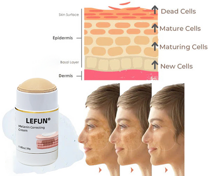 ⭐(Vente du dernier jour - 80% de réduction) - LEFUN® Crème Correctrice à la Mélanine