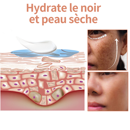 🔥(Vente du dernier jour - 80% de réduction) - LEFUN® Crème Correctrice à la Mélanine