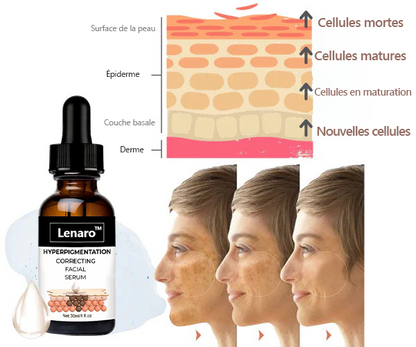 🔥VENTE DU DERNIER JOUR - 80 % DE RÉDUCTION) 🔥Lenaro™  Sérum visage correcteur de mélanine