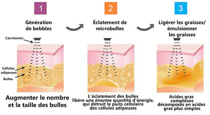 2024 Dernière version 🔥CZTICLE™ Ultrasons Liposuccion Désintoxication bracelet - Équilibrer l'énergie du corps  🎁(Offre à durée limitée + Recommandation du médecin)